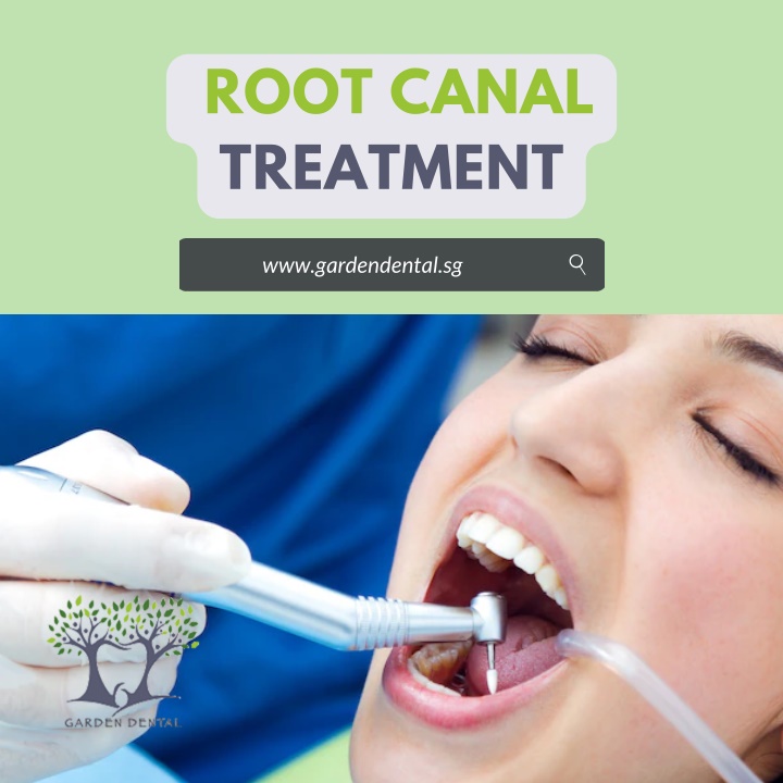 root canal treatment