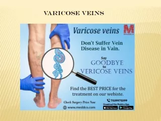 Varicose Veins
