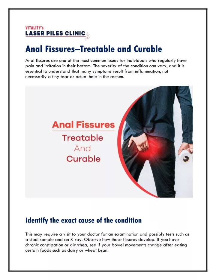 anal fissures treatable and curable