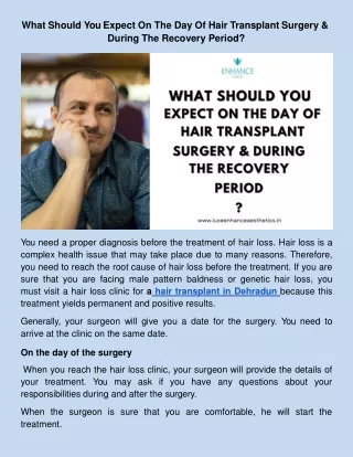 What Should You Expect On The Day Of Hair Transplant Surgery & During The Recove