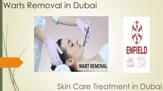 Warts Removal in Dubai