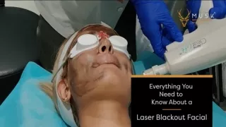 Everything You Need to Know About A Laser Blackout Facial