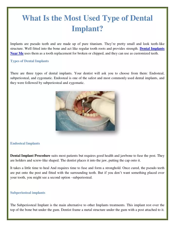 what is the most used type of dental implant