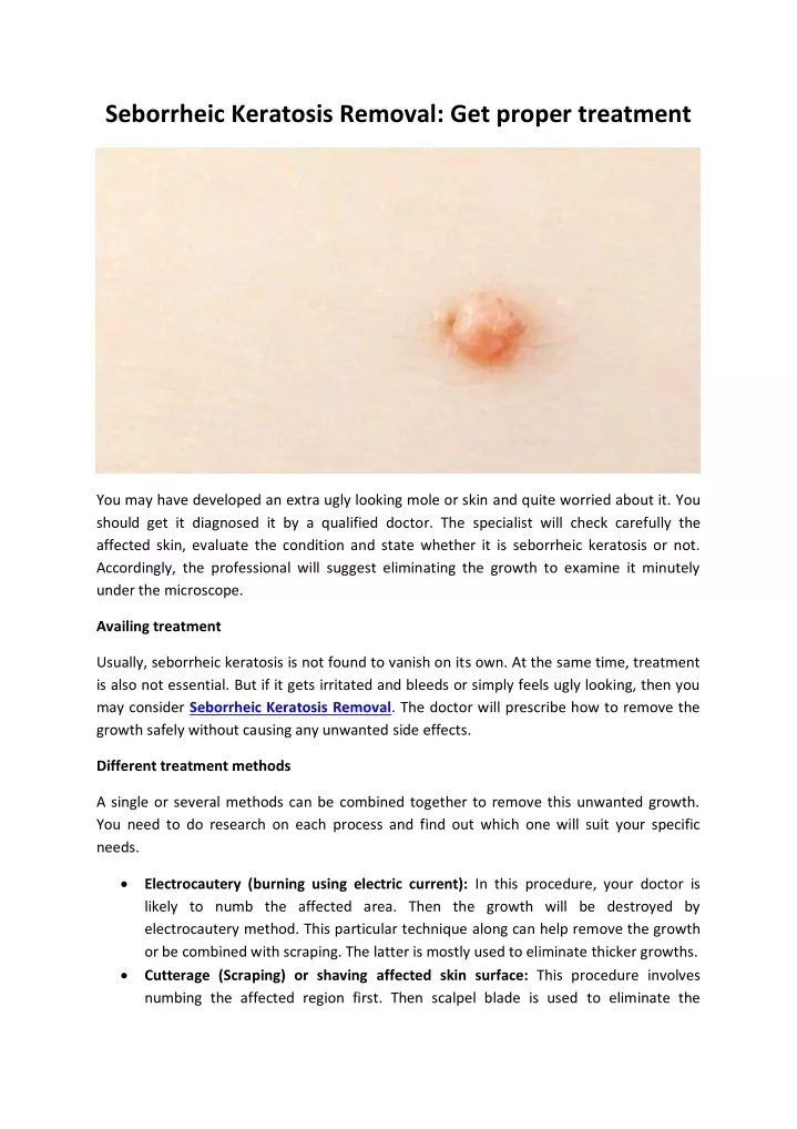 seborrheic keratosis removal get proper treatment