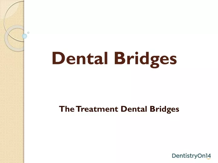 dental bridges