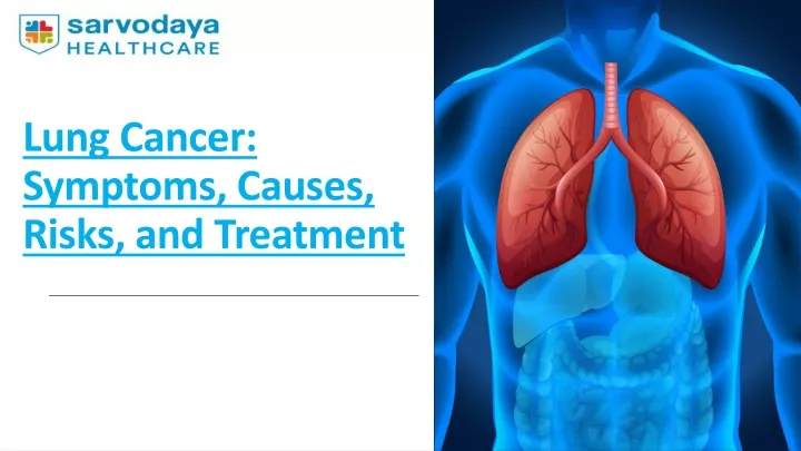 PPT - Lung Cancer: Symptoms, Causes, Risks, And Treatment PowerPoint ...