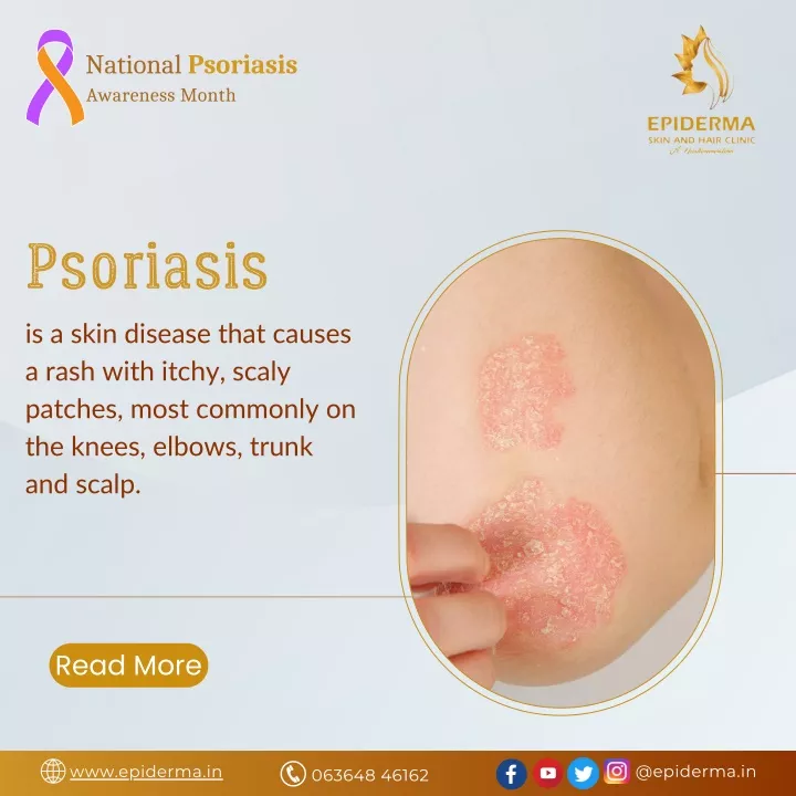 national psoriasis awareness month