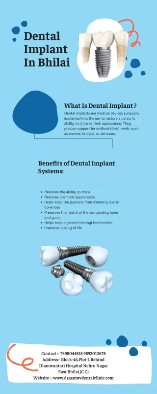 Dental Implant in Bhilai