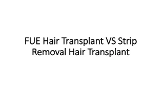 FUE Hair Transplant VS Strip Removal Hair Transplant