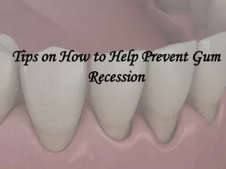 Tips on How to Help Prevent Gum Recession