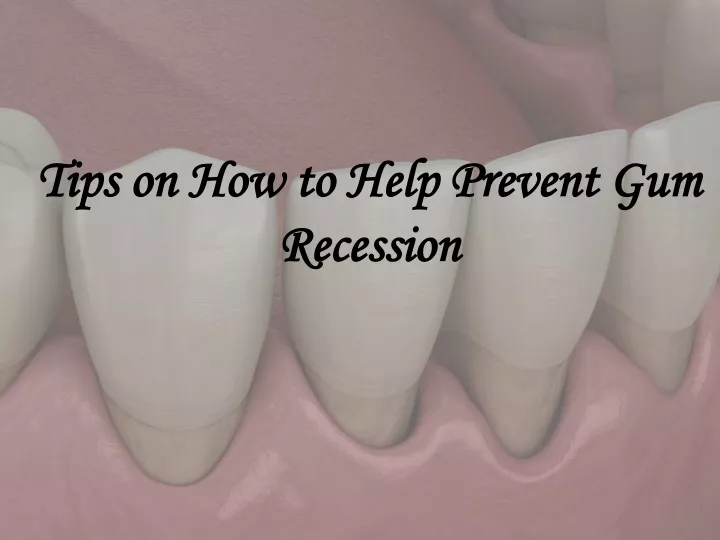 tips on how to help prevent gum recession