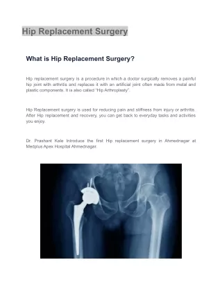 Hip Replacement Surgery - Dr. Prashant Kale