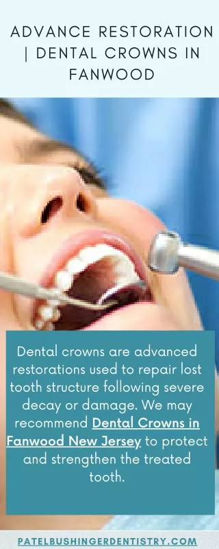 Advance Restoration  Dental Crowns in Fanwood