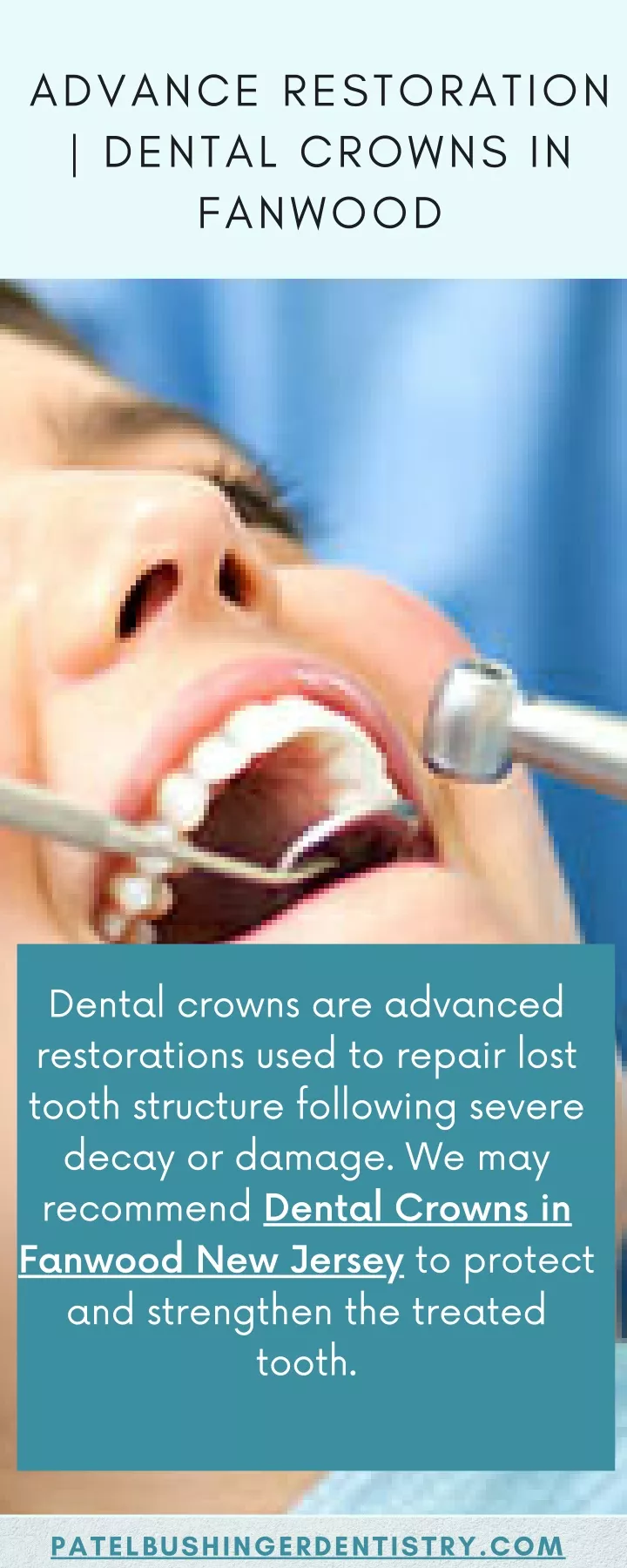 advance restoration dental crowns in fanwood