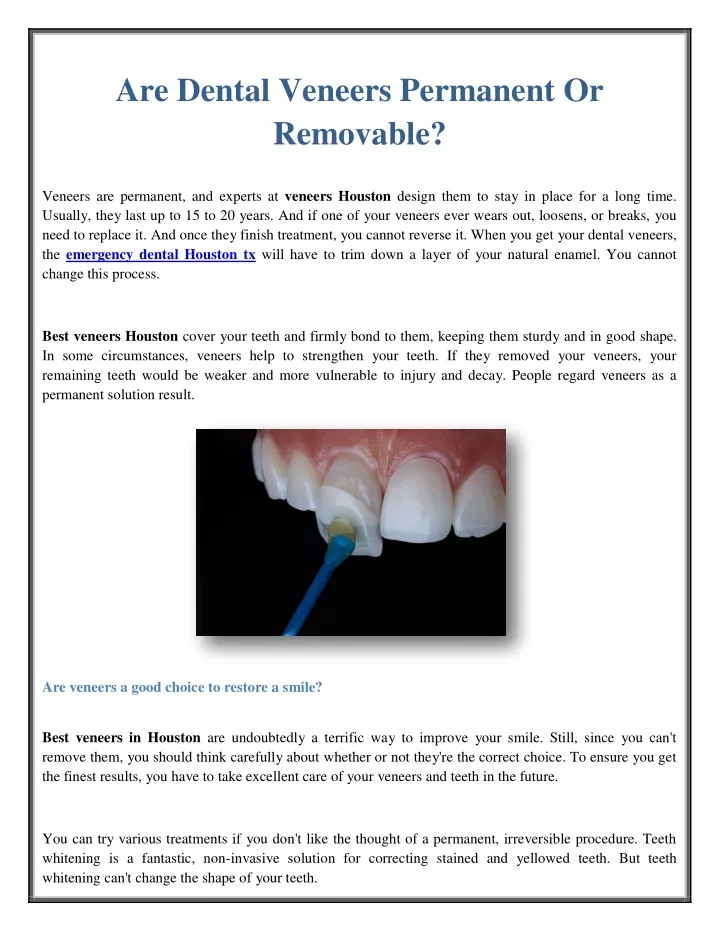 are dental veneers permanent or removable