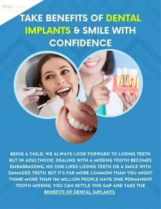 Take Benefits of Dental Implants & Smile with Confidence