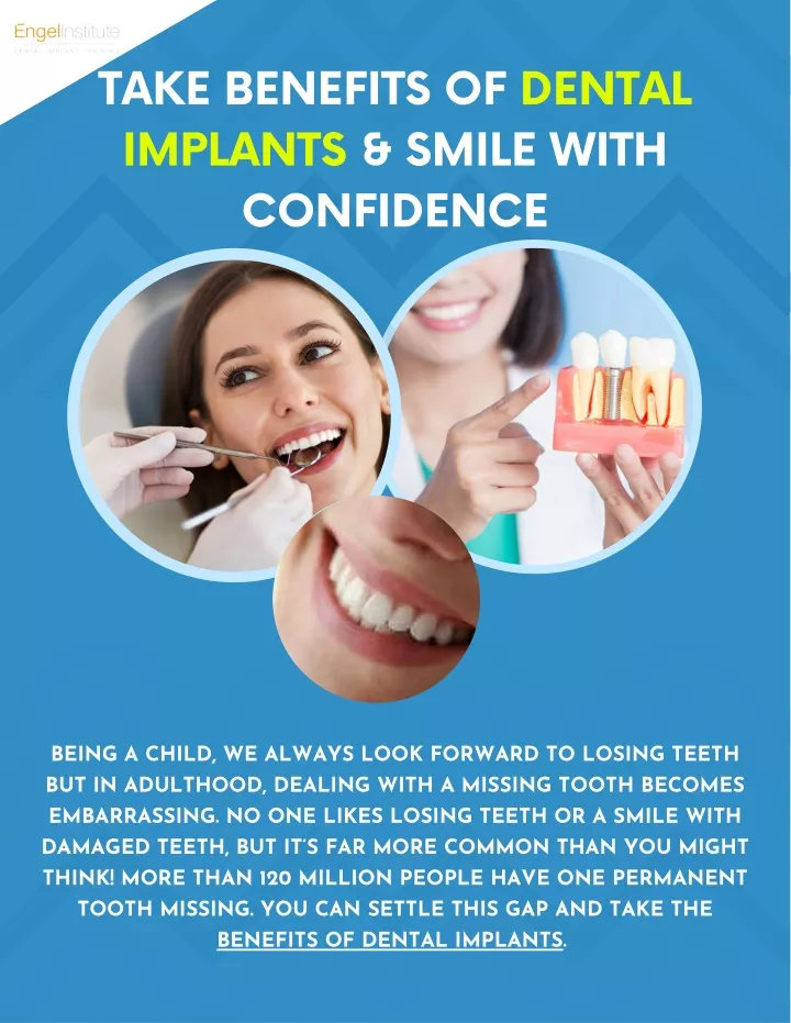 take benefits of dental implants smile with