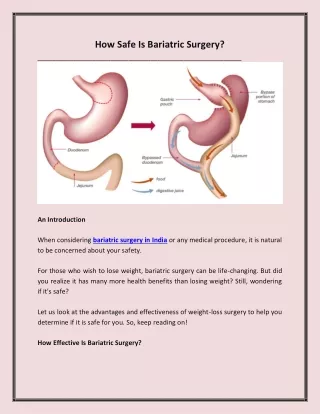how safe is bariatric surgery