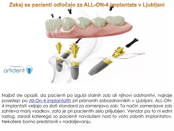 zakaj se pacienti odlo ajo za all on 4 implantate