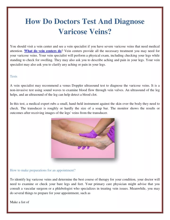 how do doctors test and diagnose varicose veins