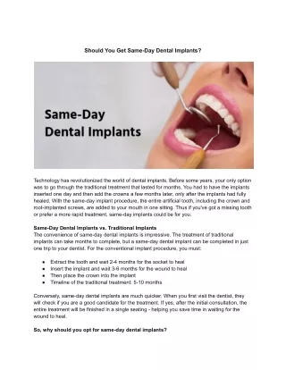 Should You Get Same-Day Dental Implants?