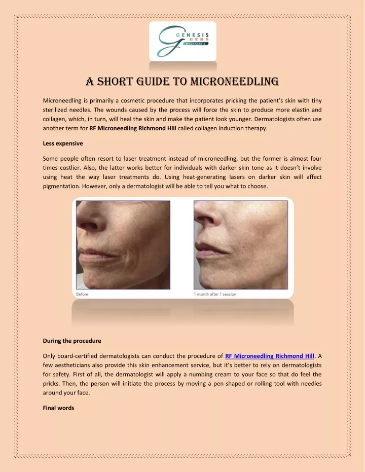 a short guide to microneedling