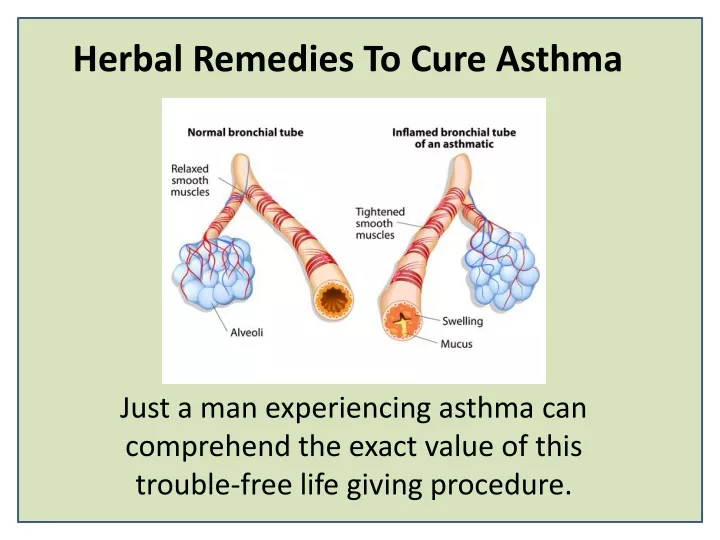 herbal remedies to cure asthma