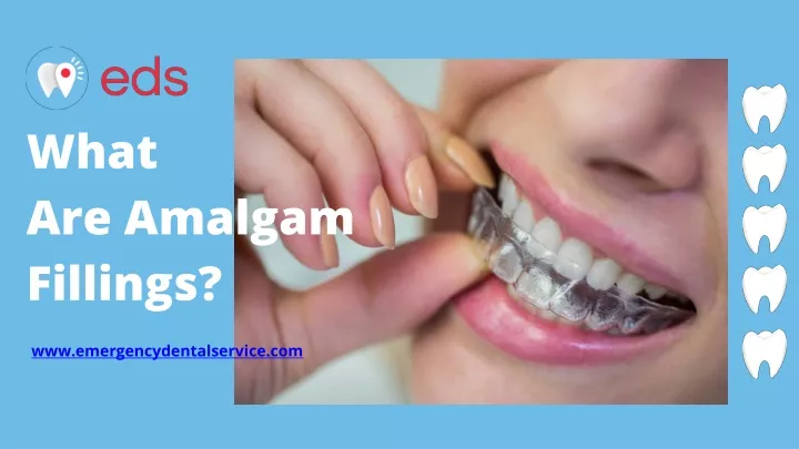 what are amalgam fillings