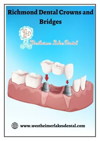 Richmond Dental Crowns and  Bridges