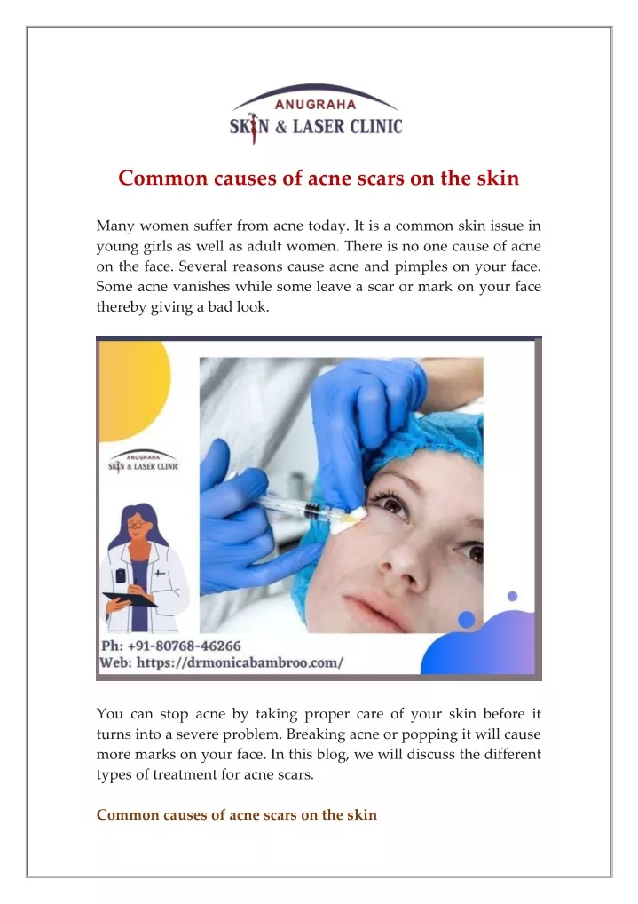 common causes of acne scars on the skin many