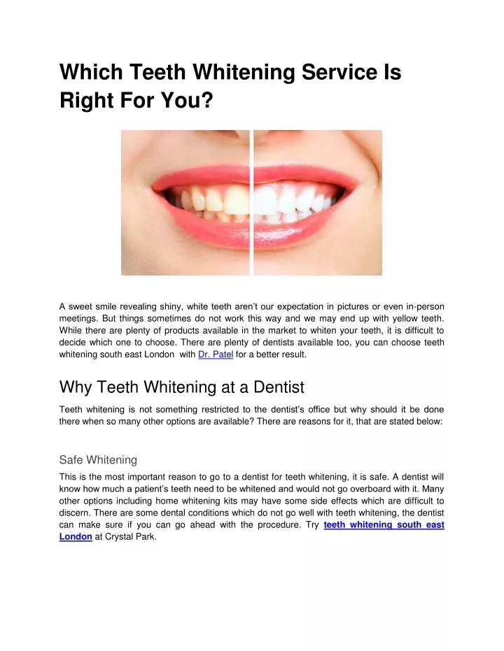 which teeth whitening service is right for you