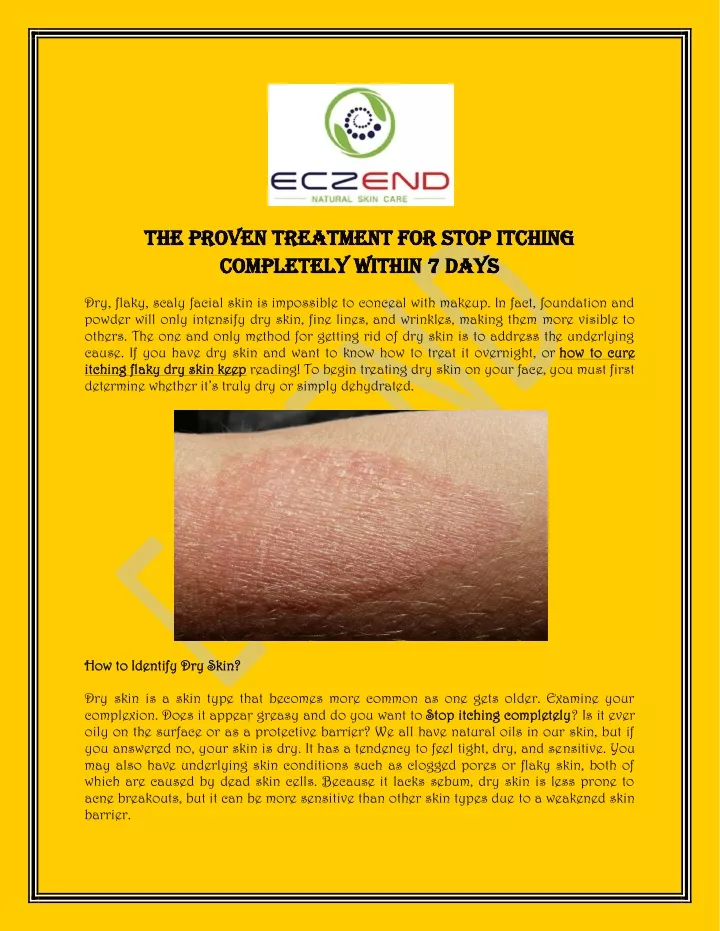 the proven treatment for stop itching the proven