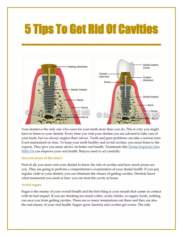 5 5 tips tips to get rid o to get rid of cavities