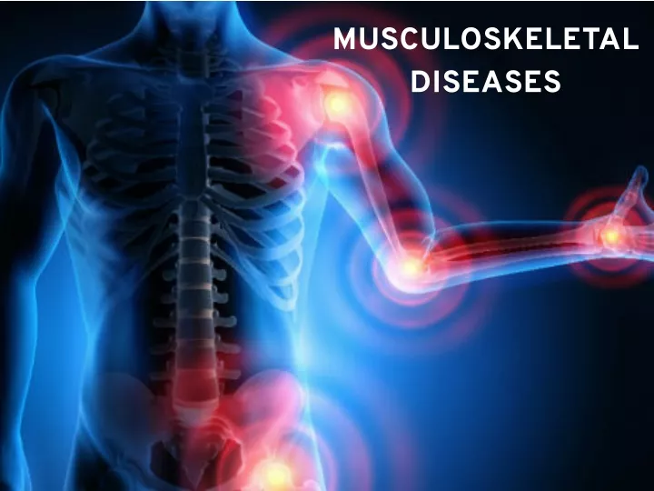 musculoskeletal diseases