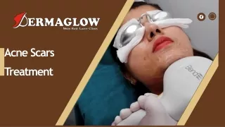 Acne Treatment In Gurgaon | Dermaglow Skin Clinic