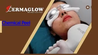 Chemical Peel | Dermaglow Skin Clinic
