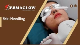 Skin Needling