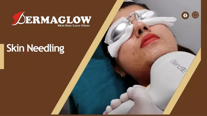 skin needling