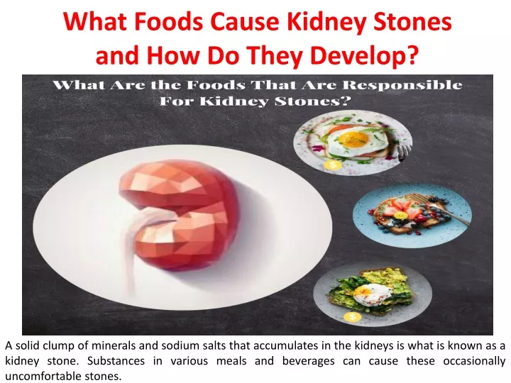 what foods cause kidney stones and how do they
