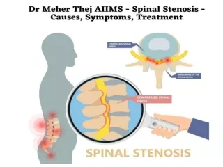 Dr Meher Thej AIIMS - Spinal Stenosis - Causes, Symptoms, Treatment