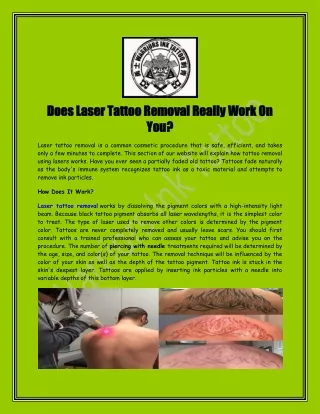 Does Laser Tattoo Removal Really Work On You