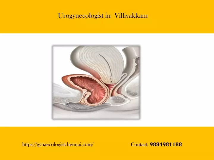 urogynecologist in villivakkam