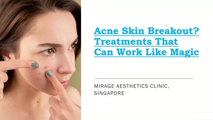 acne skin breakout treatments that can work like magic