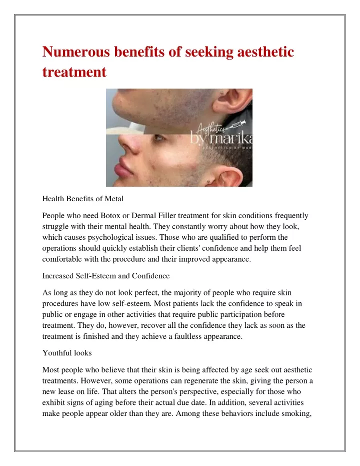 numerous benefits of seeking aesthetic treatment