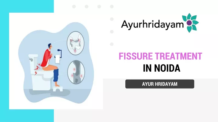 fissure treatment in noida