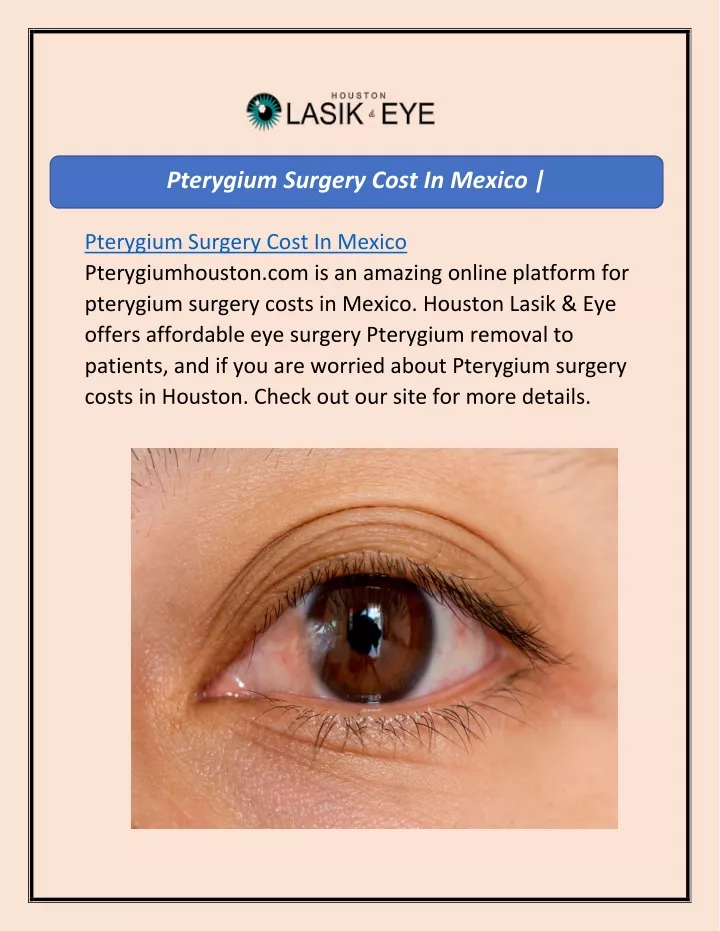 pterygium surgery cost in mexico pterygiumhouston