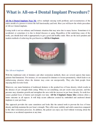 what is all on 4 dental implant procedure