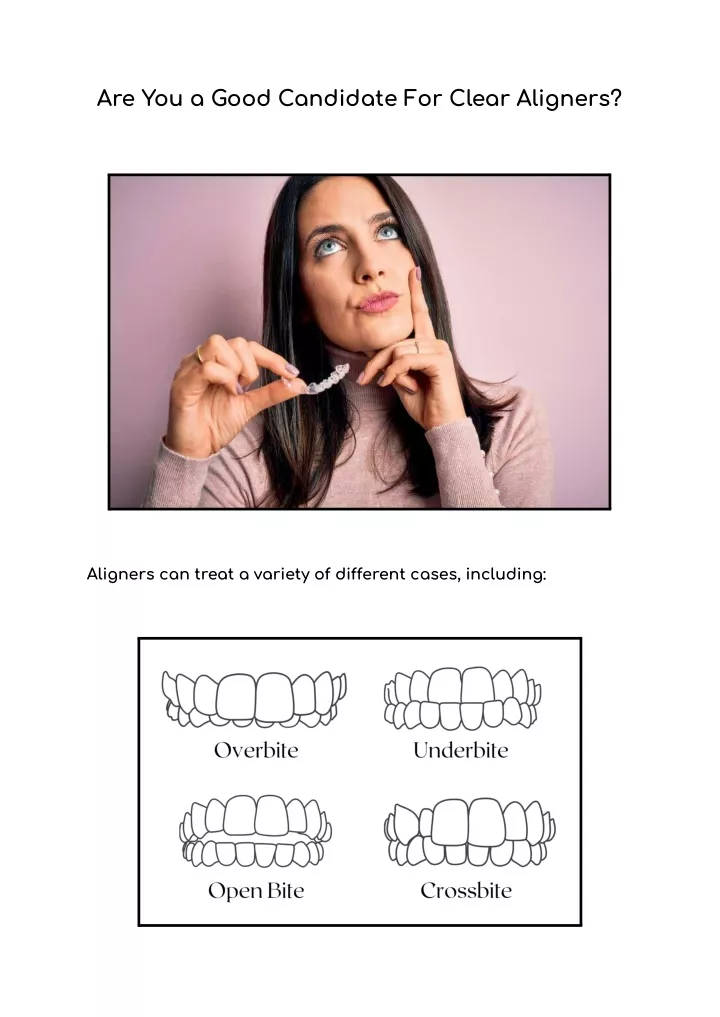 are you a good candidate for clear aligners