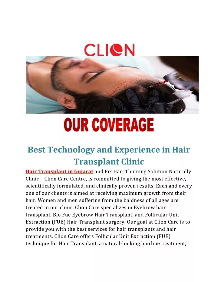 best technology and experience in hair transplant