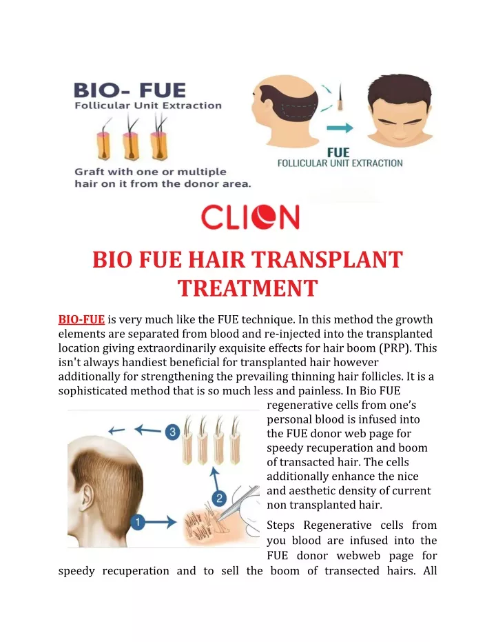 bio fue hair transplant treatment